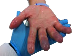 đá khô CO2 & ẩn họa nguy hiểm tác hại khôn lường